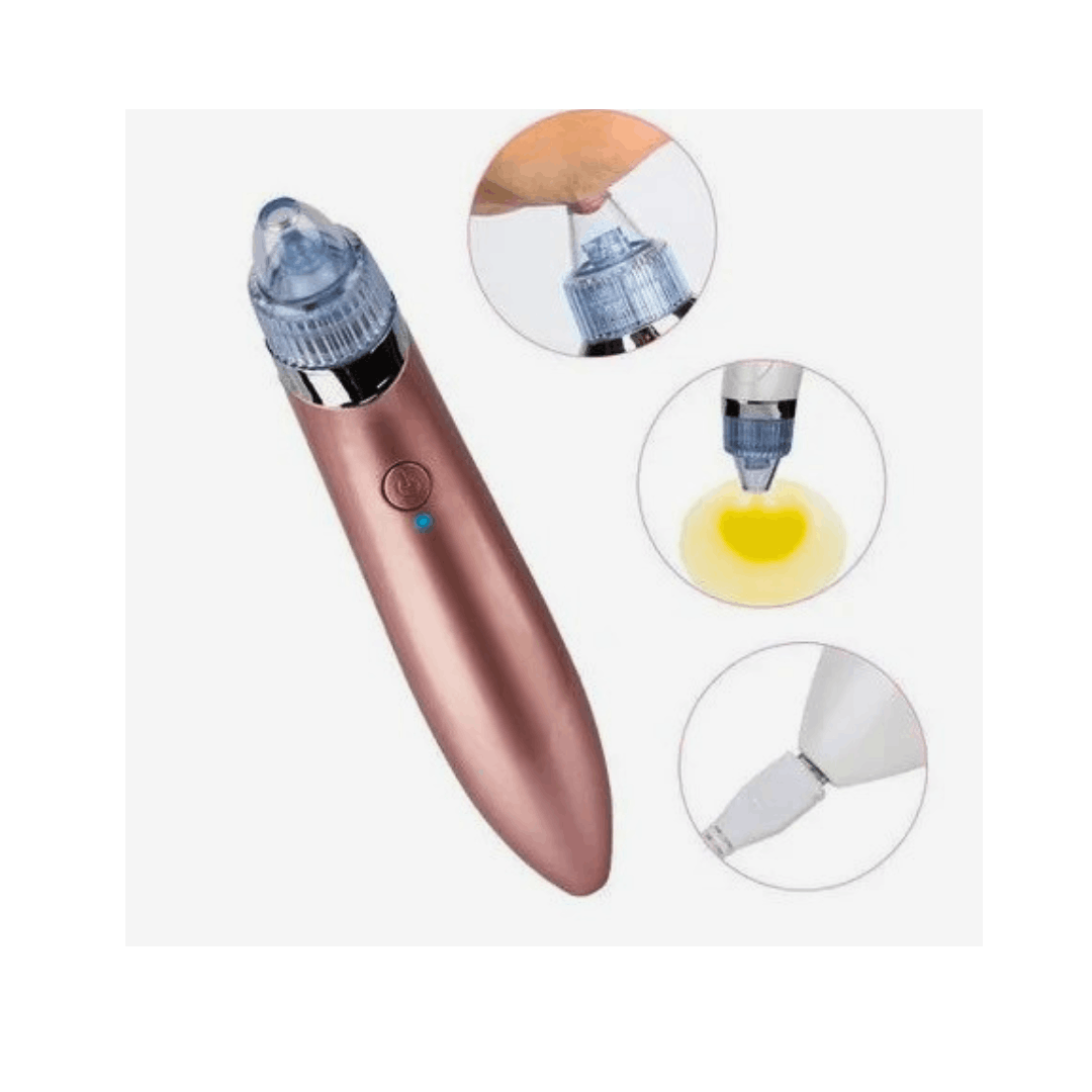 Productos Luz Vitality (93) (1) Limpiador Facial Extractor De Espinillas - Image 1